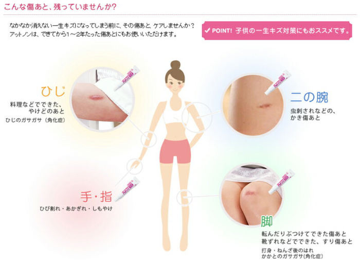 Kem trị sẹo Kobayashi Nhật Bản 15gr