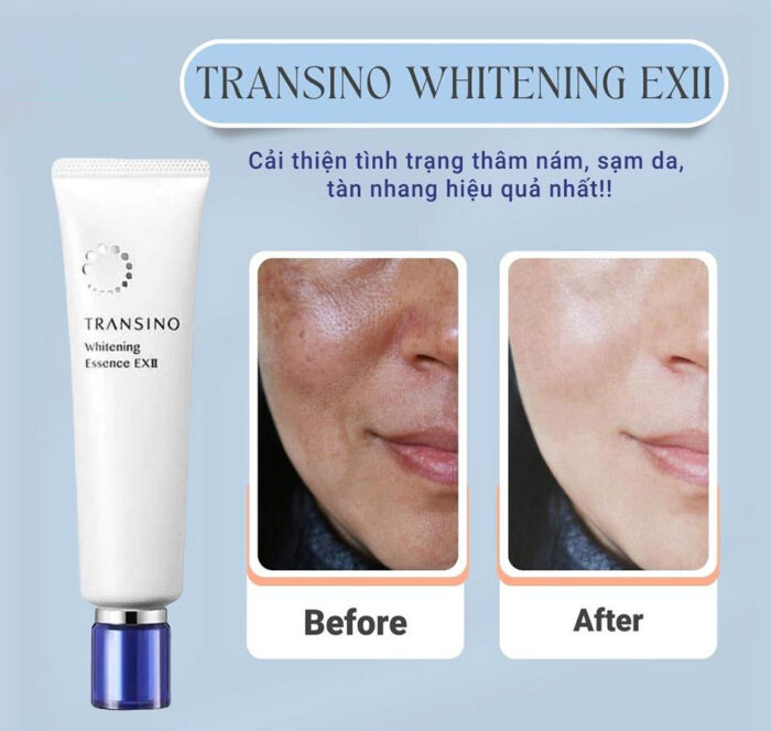 Tinh chất trị nám dưỡng trắng transino whitening essence ex 50g